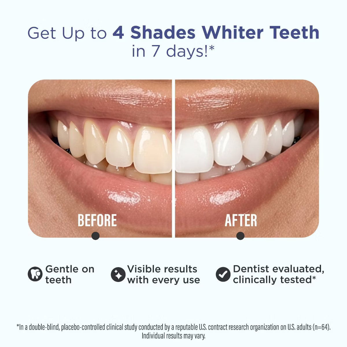 GuruNanda Teeth Whitening Strips – Mint, 14 Count, 7-Day Treatment