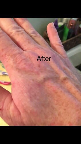 NO MORE ECZEMA – Organic Oatmeal Soap for Sensitive Skin