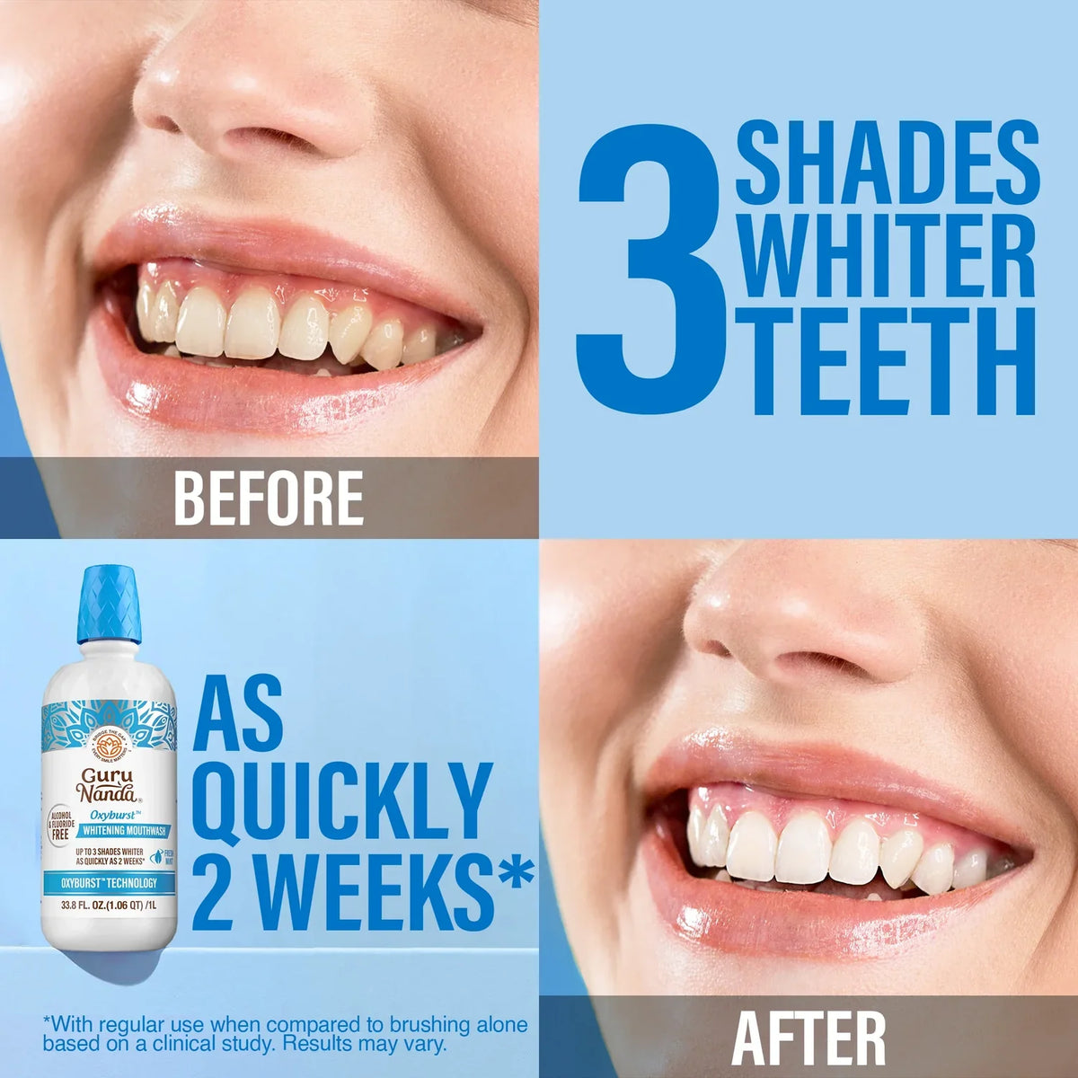 GuruNanda Oxyburst Whitening Mouthwash – Fresh Mint, 1 L