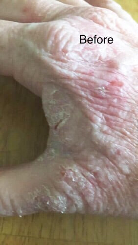 NO MORE ECZEMA – Organic Oatmeal Soap for Sensitive Skin